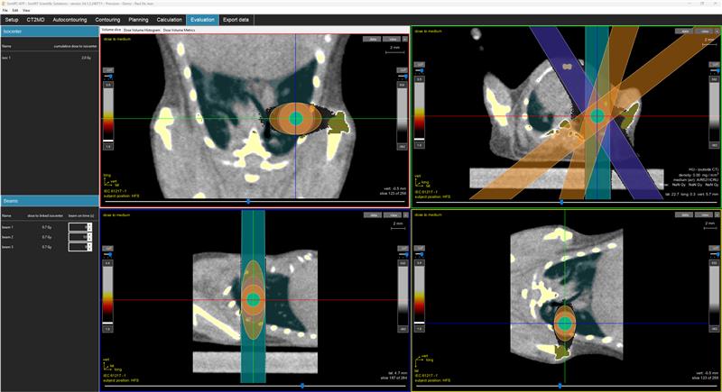 advanced treatment planning with Monte-Carlo based dose calculations.