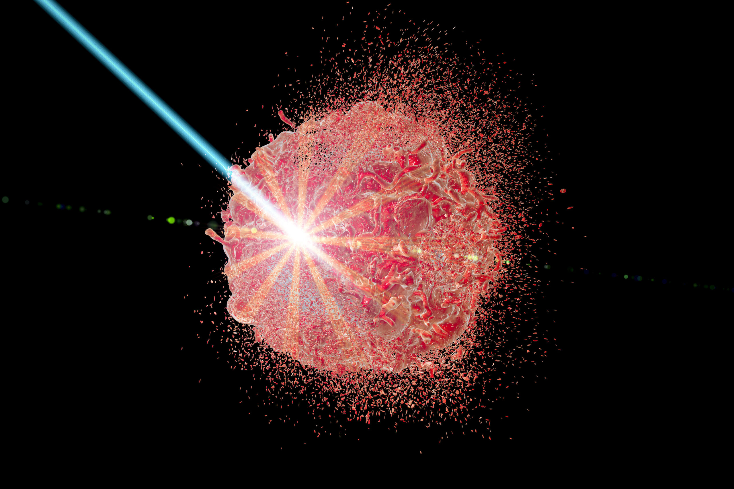 flash radiotherapy